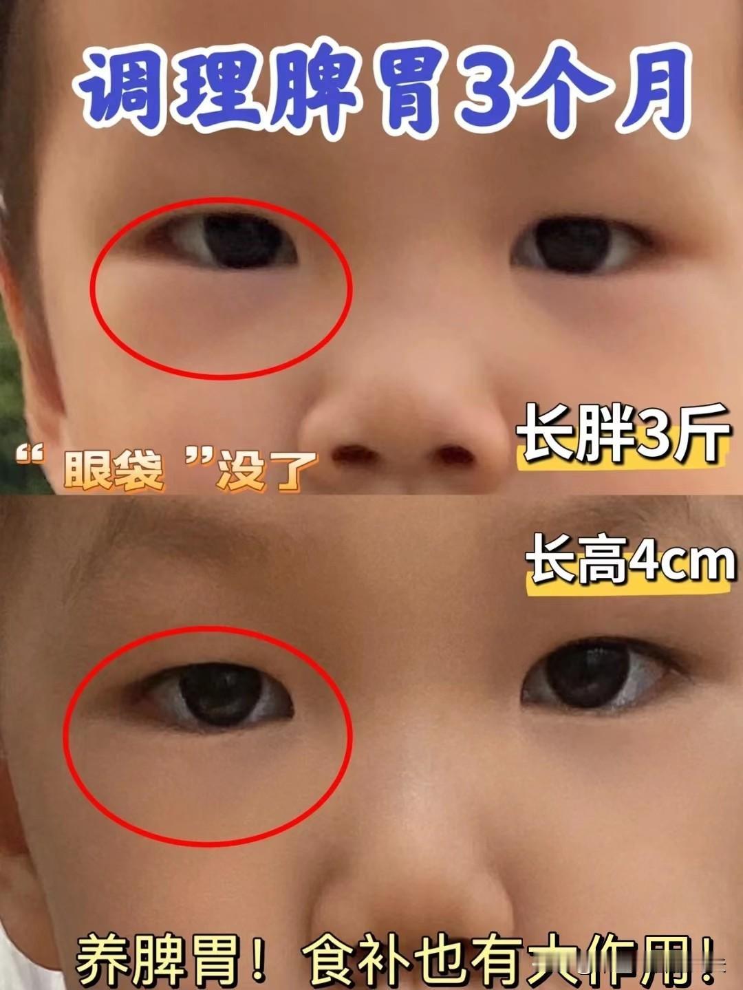 10娃9脾虚，家长不必过于焦虑，做好这5件事，强健脾胃少走弯路！
 
其实孩子脾