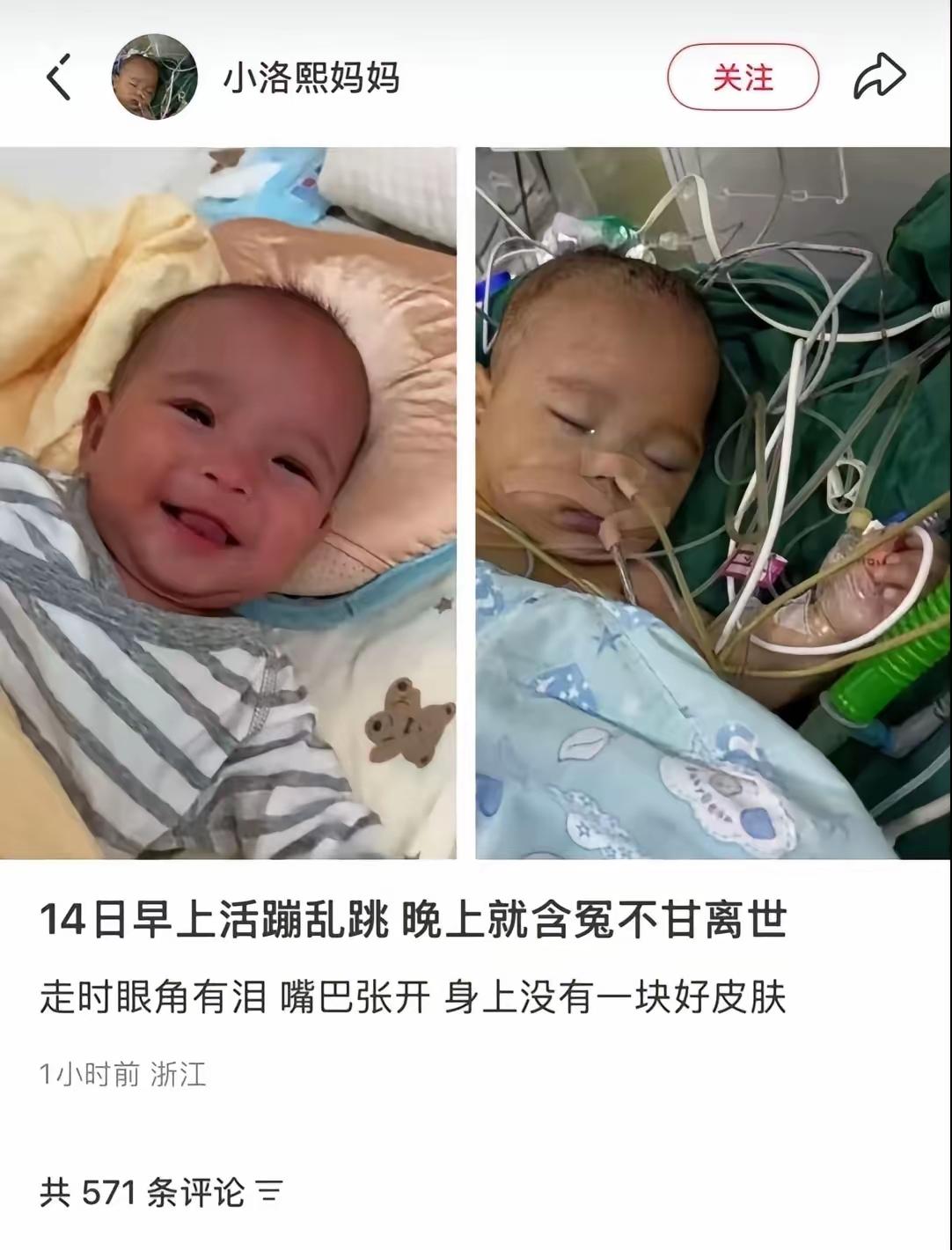 5个月大的早产宝宝，一场被医生说是“低风险”的心脏手术，怎么就再也没回家？
 