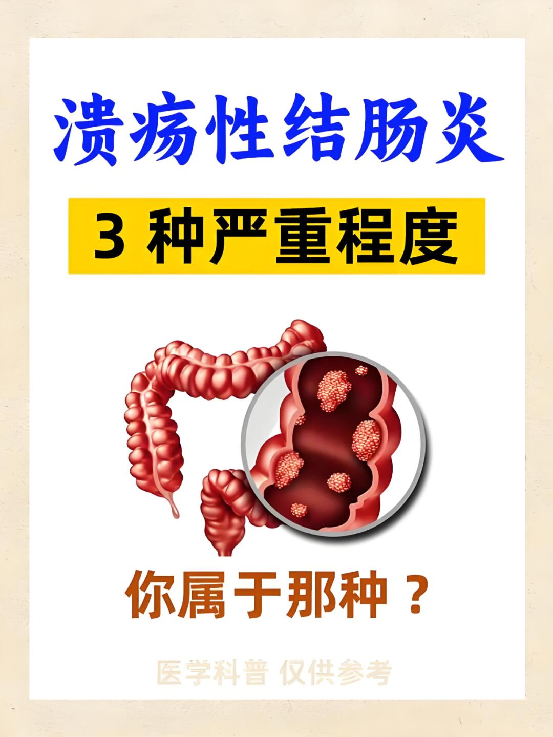 医学科普 溃疡性结肠炎 中医顾思臻 顾思臻