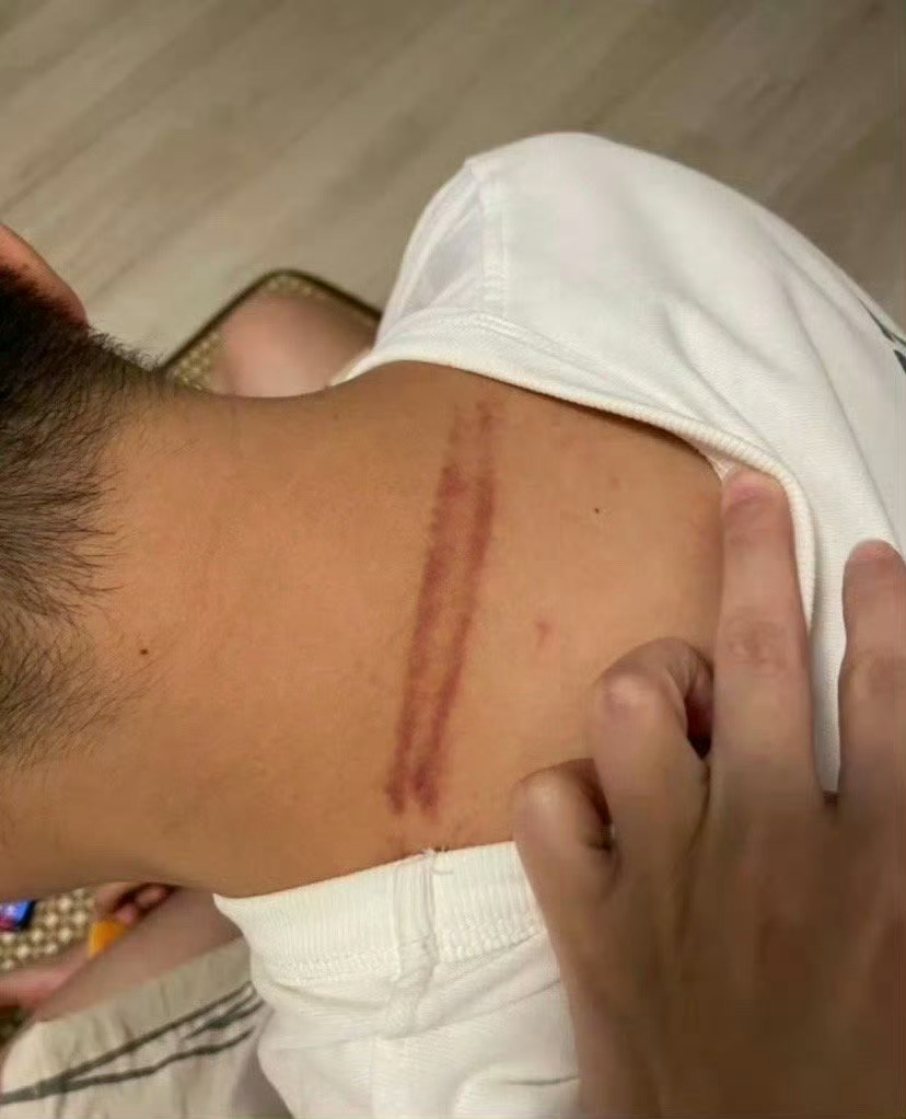 男朋友脖子上发现这个 