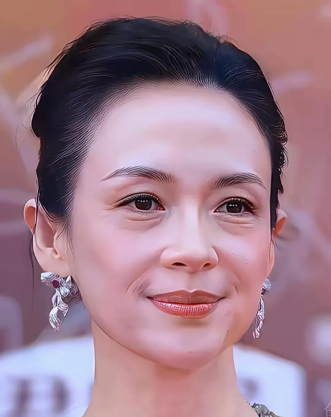 章子怡这是没恢复好就出来营业了吗？
脸部刚做完护肤，肿胀了。等一星期左右消了肿就