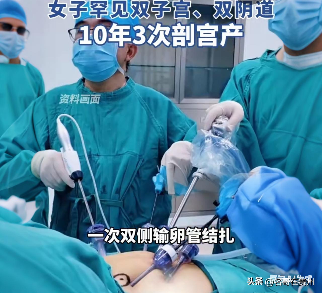 双子宫宝妈10年剖4次！医生：这手术像在肉里拆房子

你见过一个女人长两个子宫、