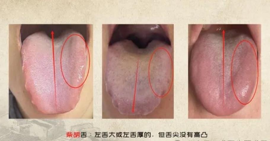 疏肝多柴胡
春天要舒肝理气，肝气在春天要生发，生发不好就容易有郁结。肝就像一棵树