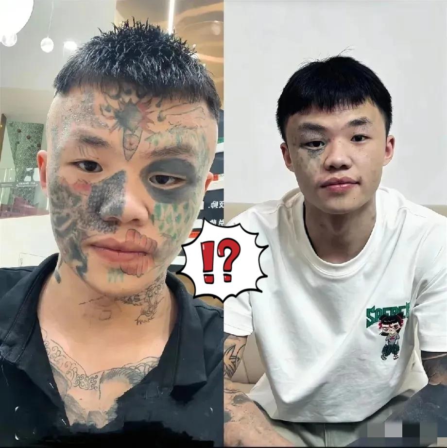 “后悔了吧？”
 
06年广东男孩夏朝勇咬着牙挨第五次激光洗纹身时，大概早忘了1
