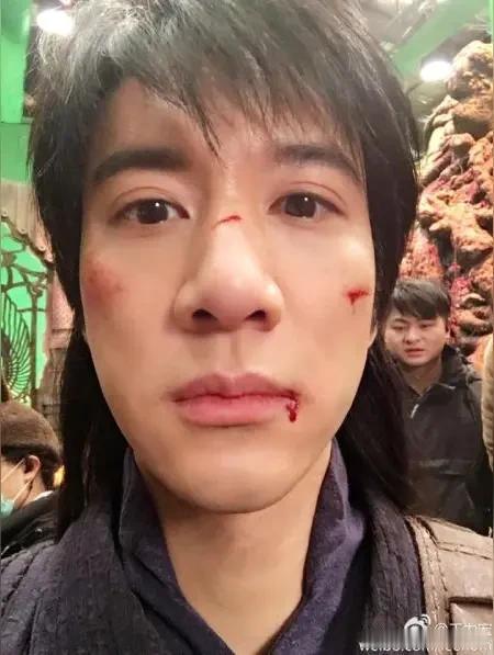 舞台意外突袭成都演唱会，王力宏登台互动期间摔伤面部挂彩，敬业举动引得全场观者动容