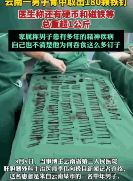 解释不清了！云南，一男子腹部剧痛送医，医生检查后当场被吓退三分：他体内居然塞满了