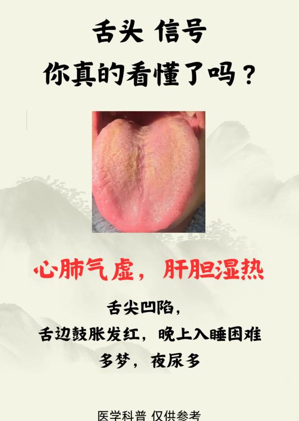 舌苔暗藏健康密码，你真的会看懂吗？