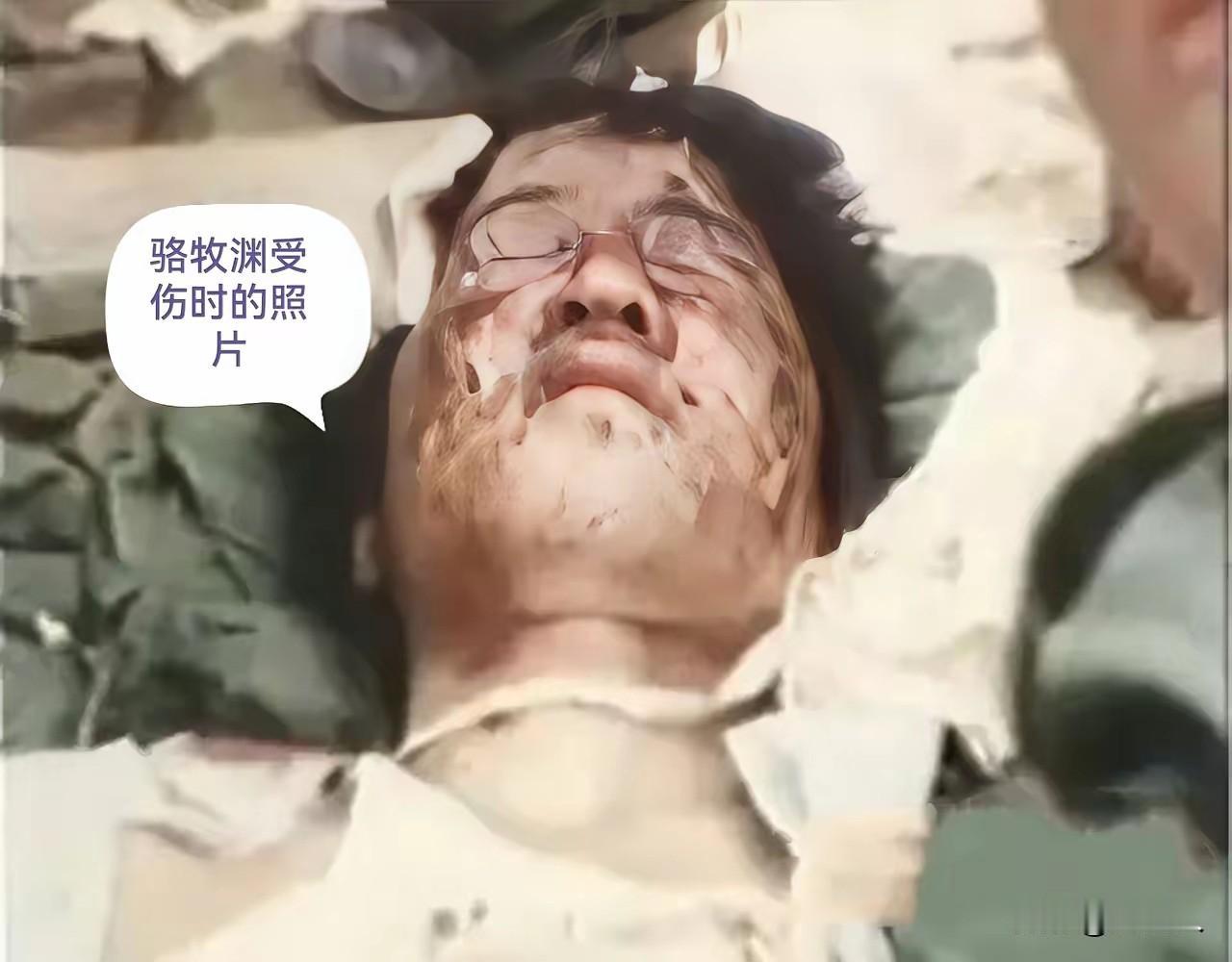 老山排雷英雄骆牧渊：17岁少年浴血边疆，身残志坚铸军魂
 
这位躺在医院病床上的