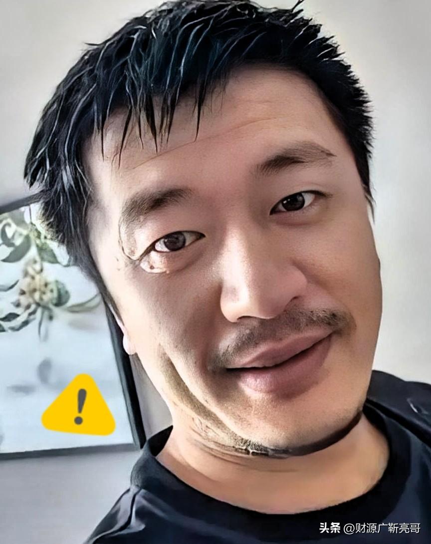 看张雪峰近几日的状态，真的是替他捏把汗。

嘴唇发紫，黑眼圈重得连滤镜都快盖不住