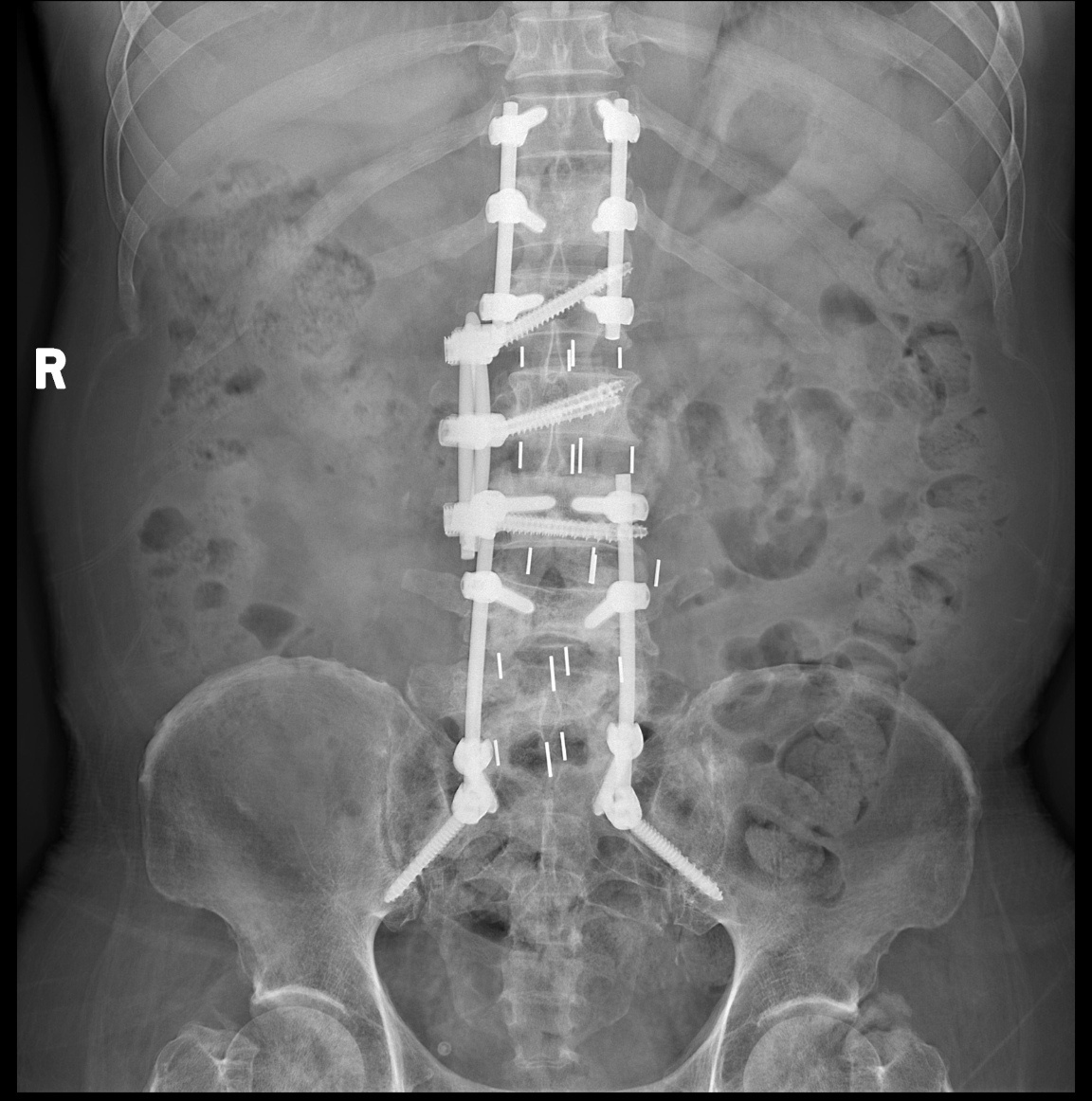 背后有多少心酸，心碎啊 ​​​