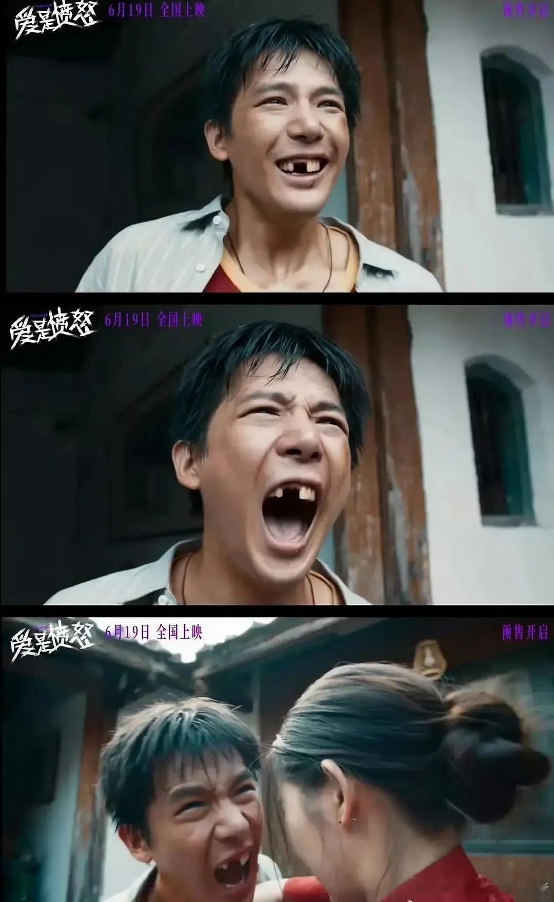 王安宇新片缺牙齿镜头，真的好突破的造型😢 