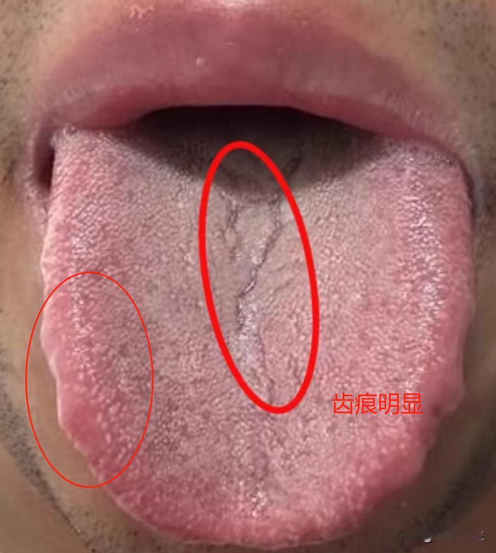 三十岁的年龄，六十岁的舌头，功能不行就别乱补，知道自己是怎么回事吗？

主诉：功