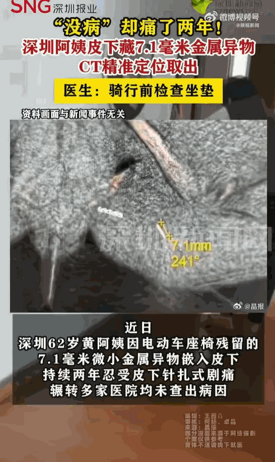 悲剧还是发生了！广东深圳，一62岁阿姨被外阴针扎般的剧痛折磨了整整两年，每走一步