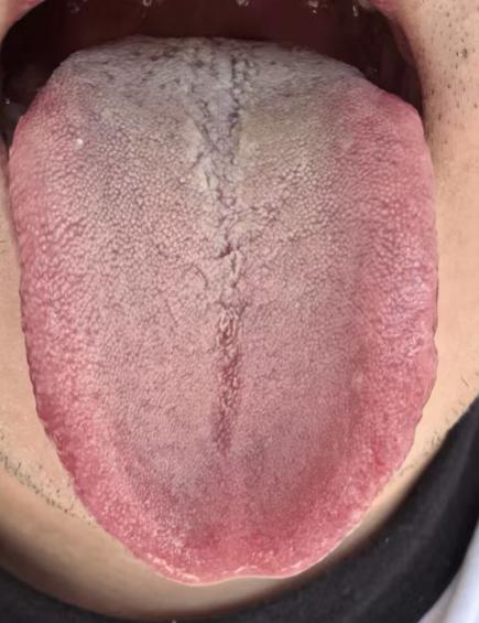 告别海绵体萎靡，补足精血重拾雄风





不少网友过往都会有纵欲过度的陋习，白