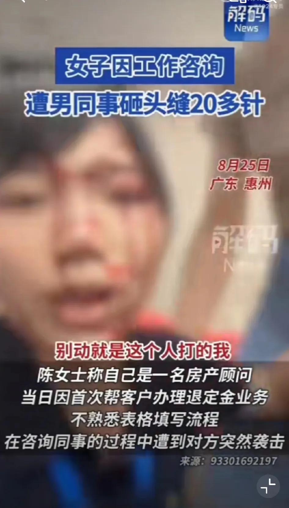 无缘无故被男同事打，脸上被缝了20来针，并且还有毁容的风险。

这女的点子也太背