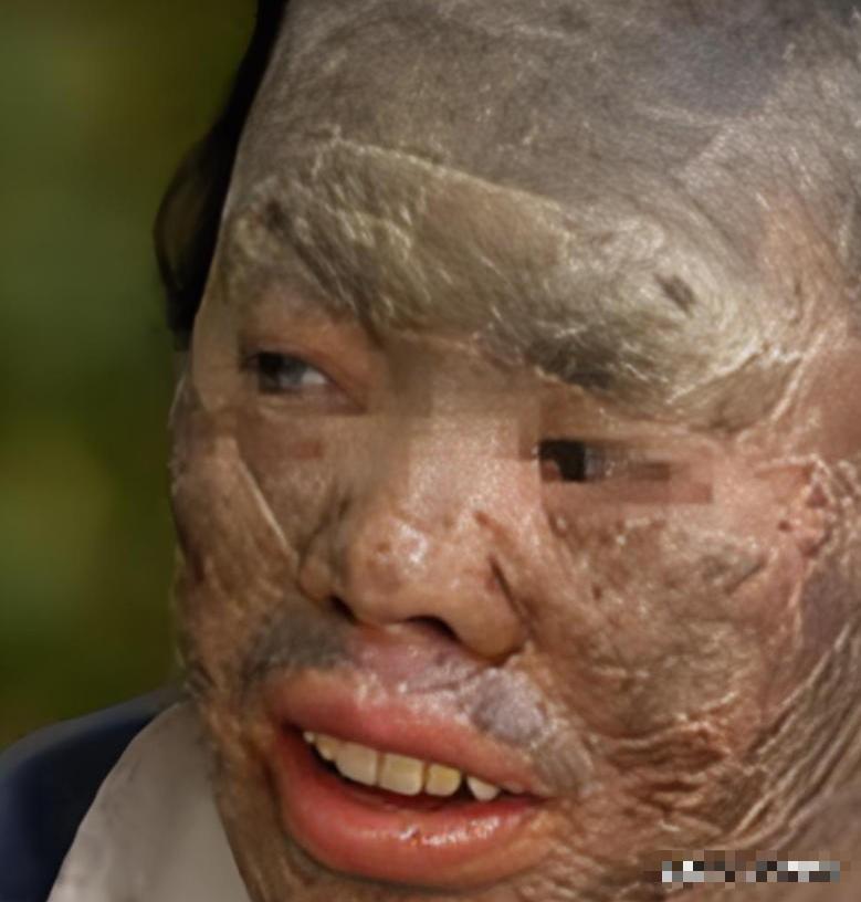 吃蛇太多变蛇人？2003年辽宁省，村民韩永波有个特殊的爱好——爱吃蛇，不仅顿顿有