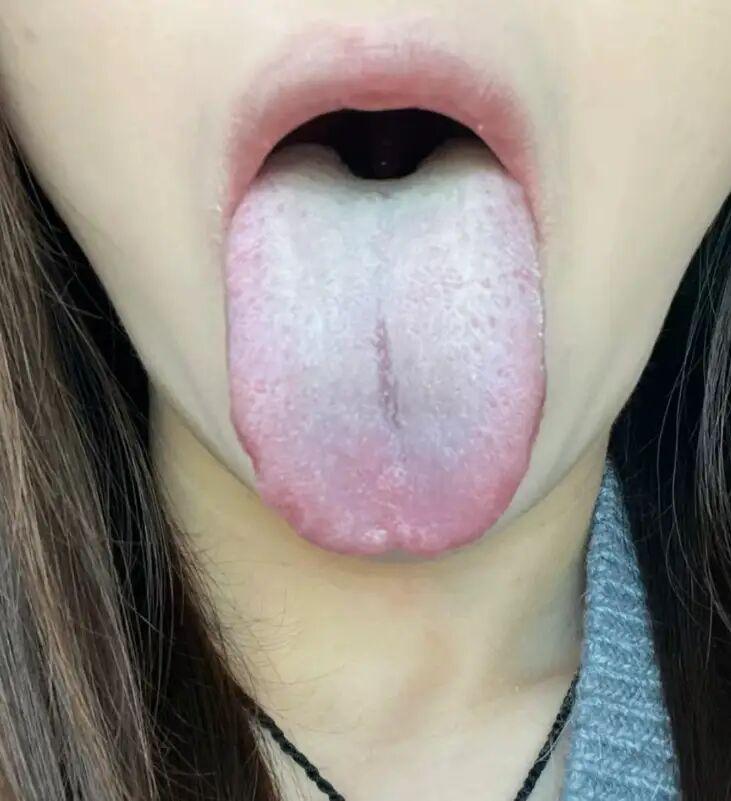 盲目补脾陷困境，肝郁脾虚真相浮现
患者自认为是脾胃问题，便擅自进行补脾治疗，结果
