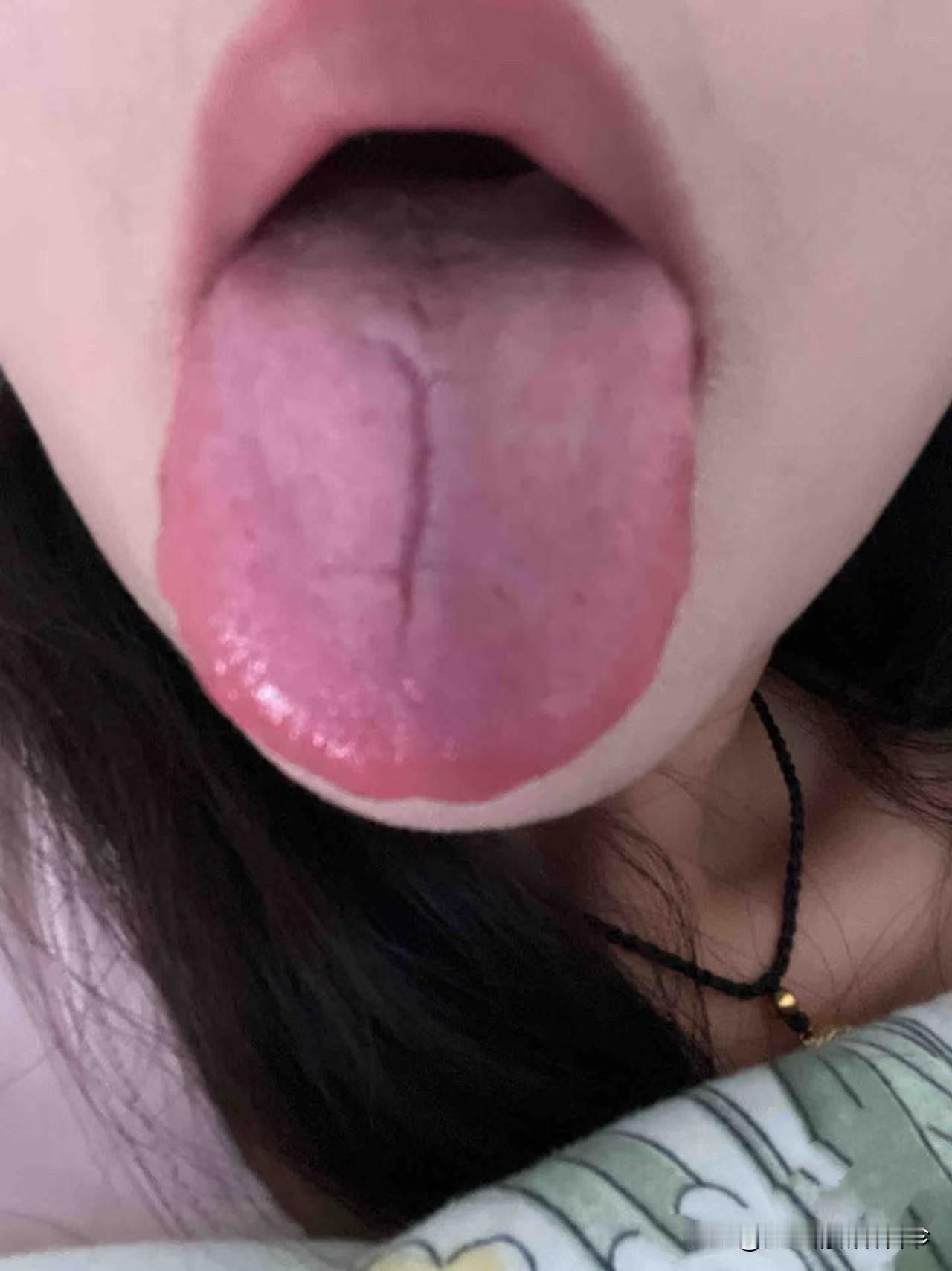 21岁小妹妹，若再不节制，肾精就要亏没了！

今天在门诊遇到一位小妹妹，上来就嚷