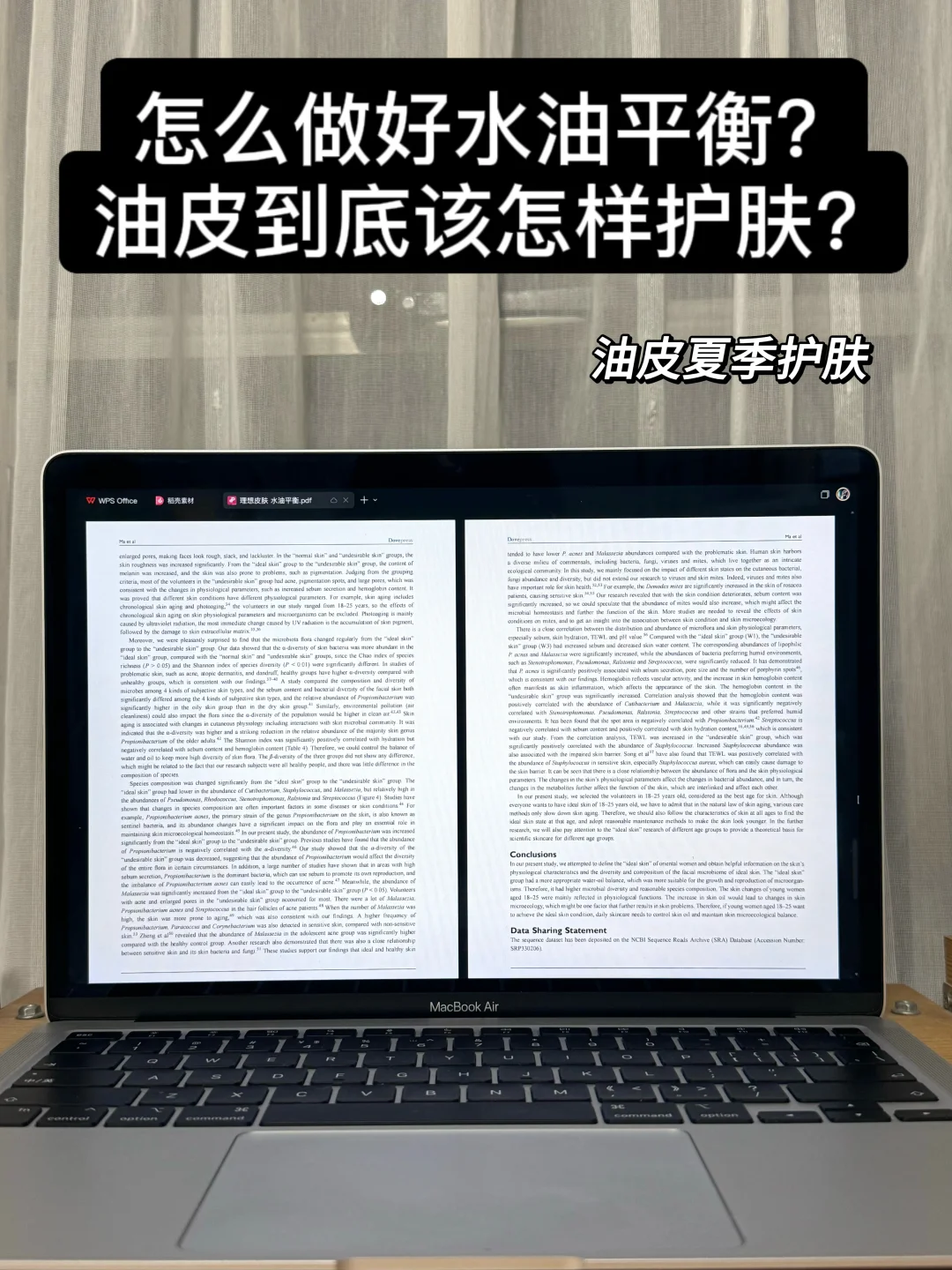 油皮的正确护肤方式！