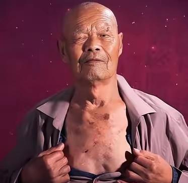 1956年，35岁的农民咳嗽10年，但却一直拒绝就医，一天，他突然用力一咳，一个