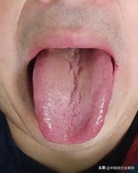 千万不要只调理男科，要找问题根源[吃瓜群众][吃瓜群众][吃瓜群众]
粉丝反馈：