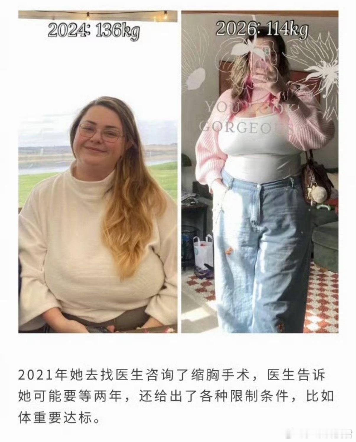 英国女子因胸部过大严重影响生活旱的旱死，涝的涝死