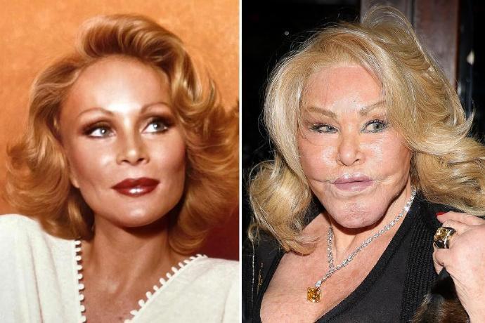 亿万富翁、社交名媛“猫女”乔斯林·威尔顿斯坦（Jocelyn Wildenste