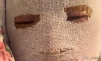 冷冻年糕一炸险毁容！安徽大姐热油溅脸，正确处理方法赶紧记
 
这事儿看得人直咧嘴