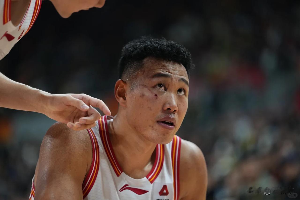 看了贺希宁这张伤痕累累的脸，才明白我们CBA联赛的对抗强度不是一般的大！[捂脸]