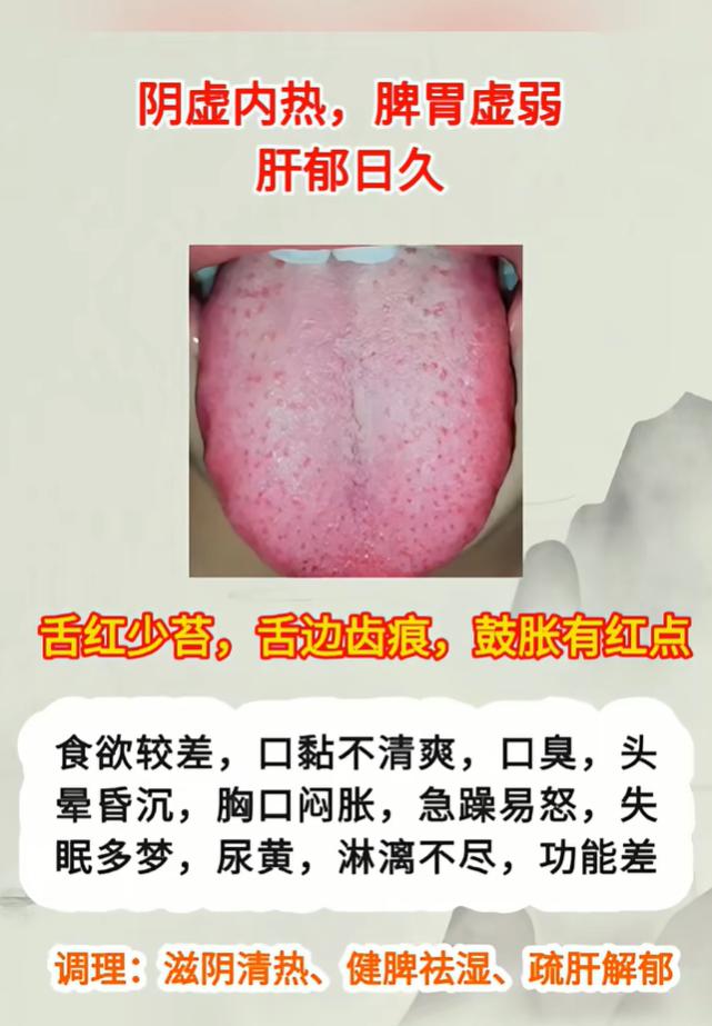 虚证夹杂分不清？3 组舌象看懂身体问题