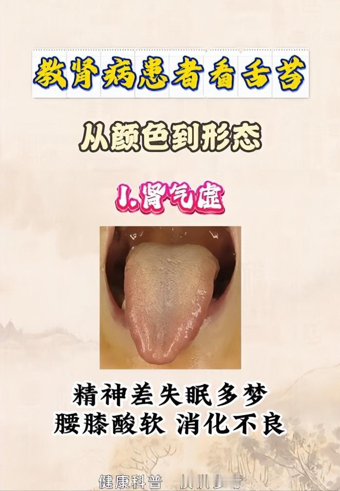 教肾不好的朋友看舌苔，从颜色到形态~