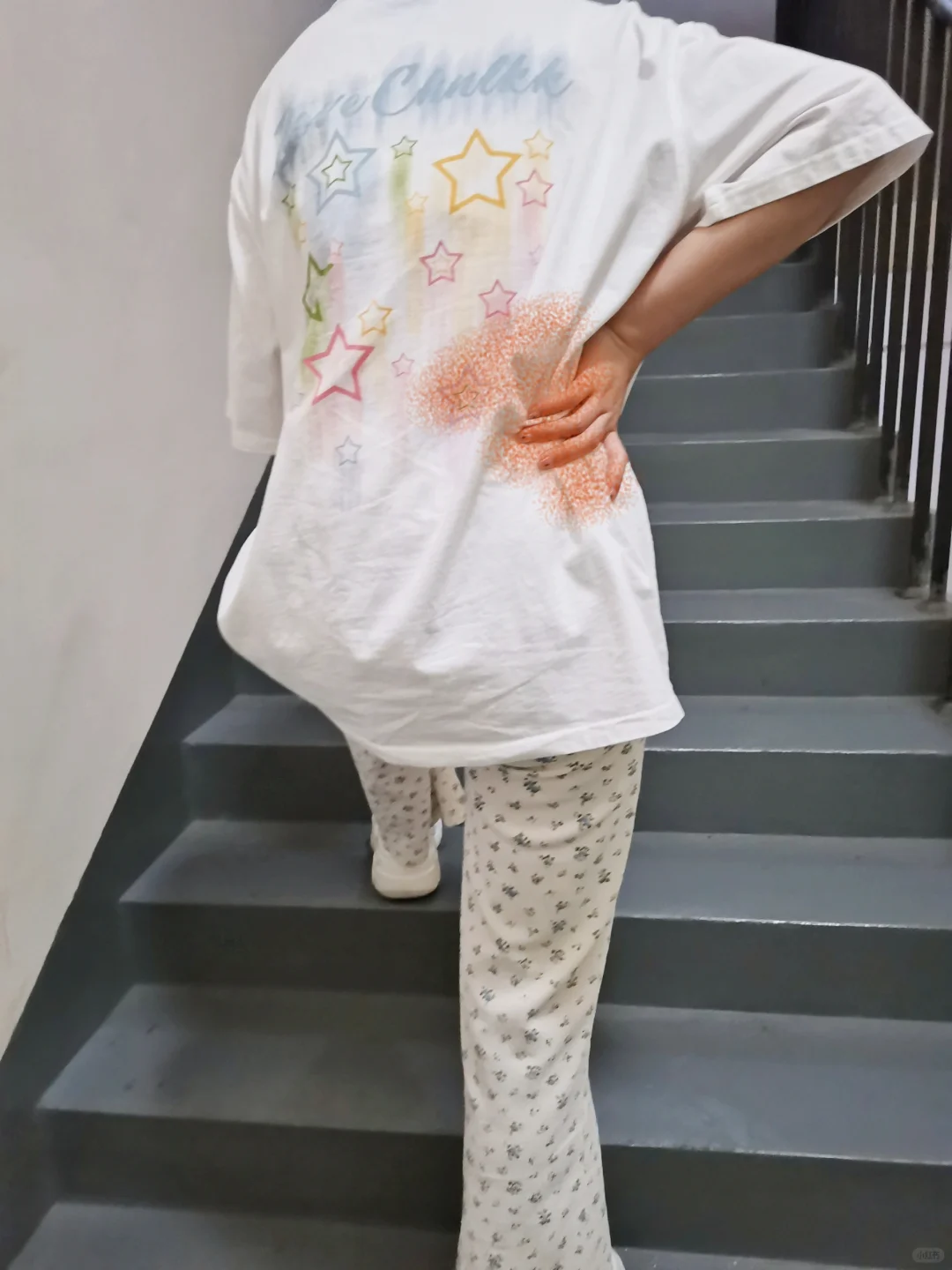 服了，着急上楼梯把腰伤了......