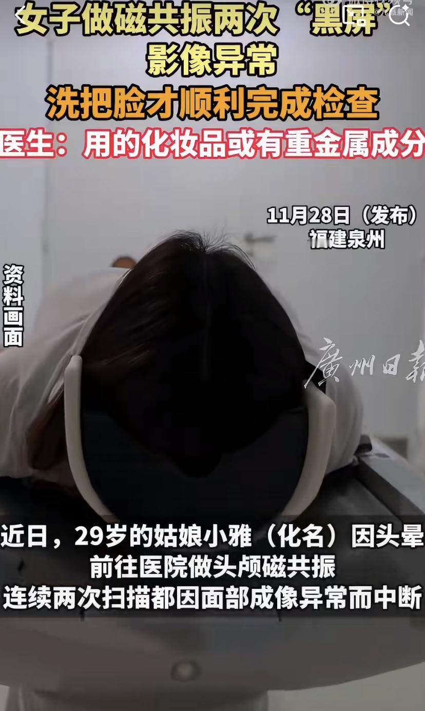 做个磁共振检查，结果竟然被脸上的妆给“搅黄”了!
前几天，泉州一位29岁的姑娘小