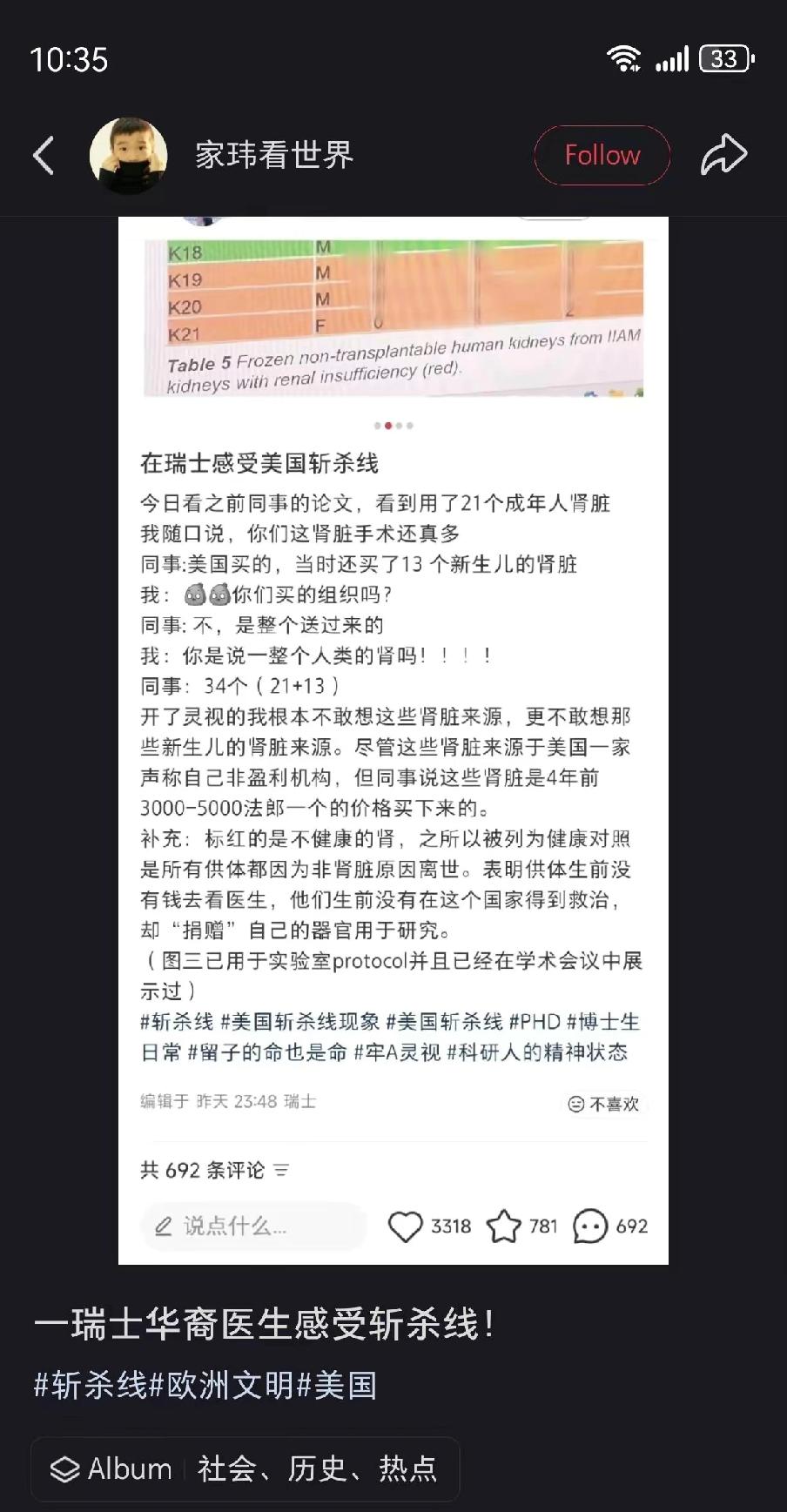 在瑞士感受美国的“斩杀线”画面感具体化

瑞士实验室里国医学生随手一掀，冰柜里放