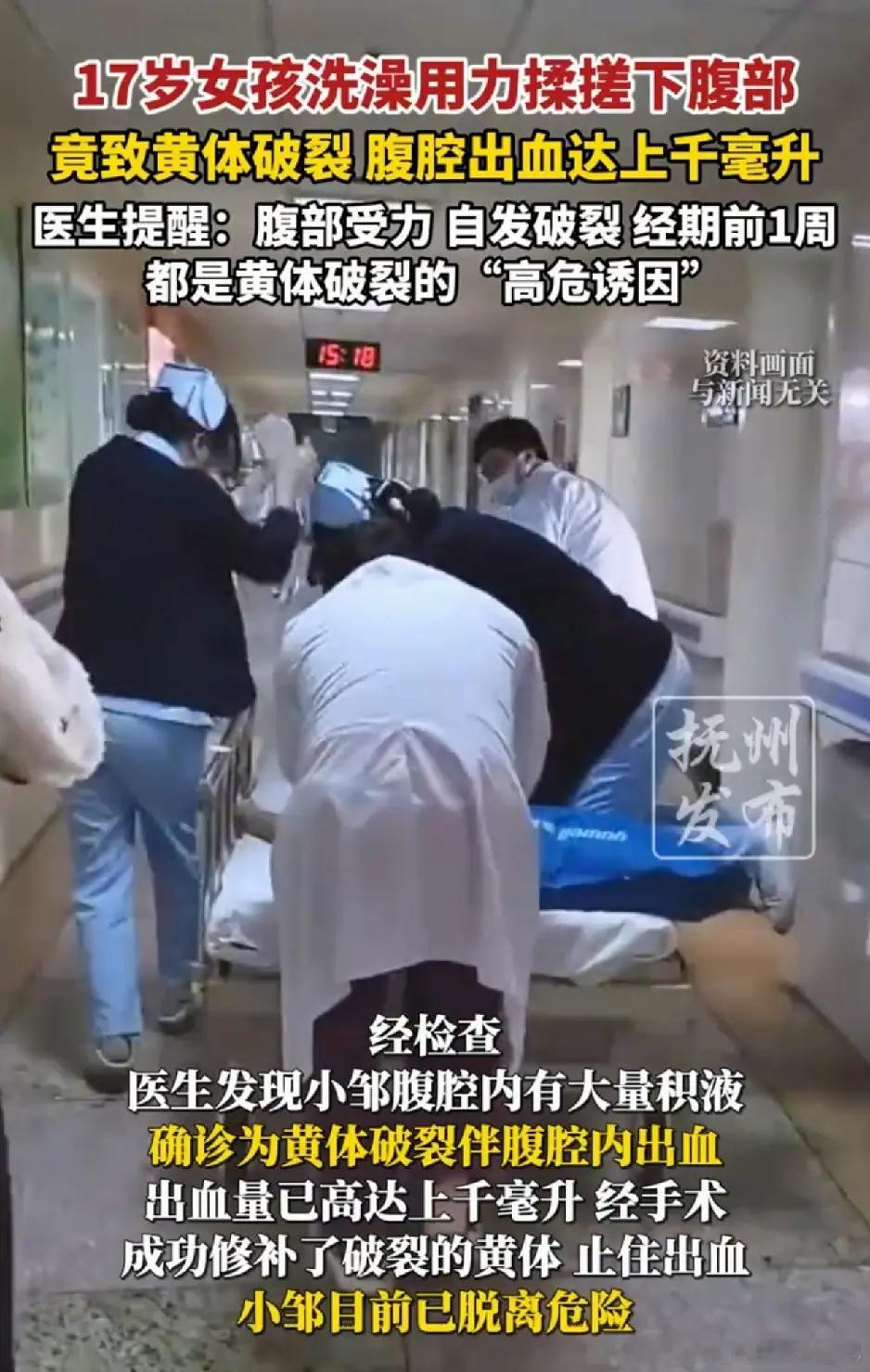 医生回应17岁女孩用力搓澡致黄体破裂17岁女孩洗澡搓腹后黄体破裂 以前我觉得黄体