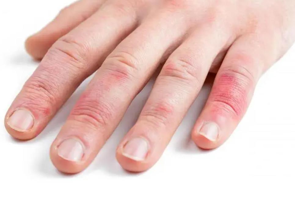 57岁女子确诊肺癌，强忍泪水坦言：“手部早出现了问题，没有多重视”

“如果早点