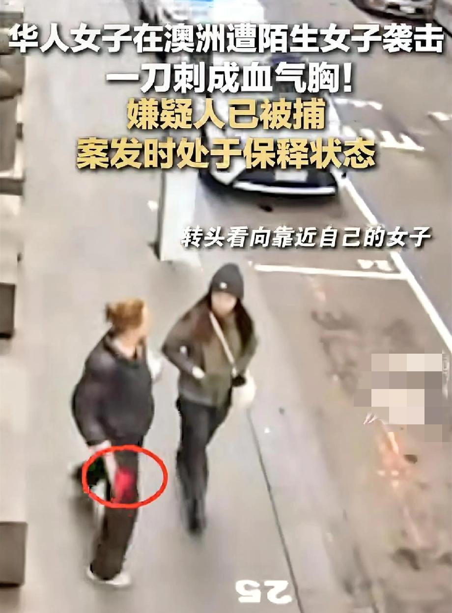 这句话出国的朋友真的得记住啊！
在背后听见跑向你的声音，就应该开始准备防御了，不