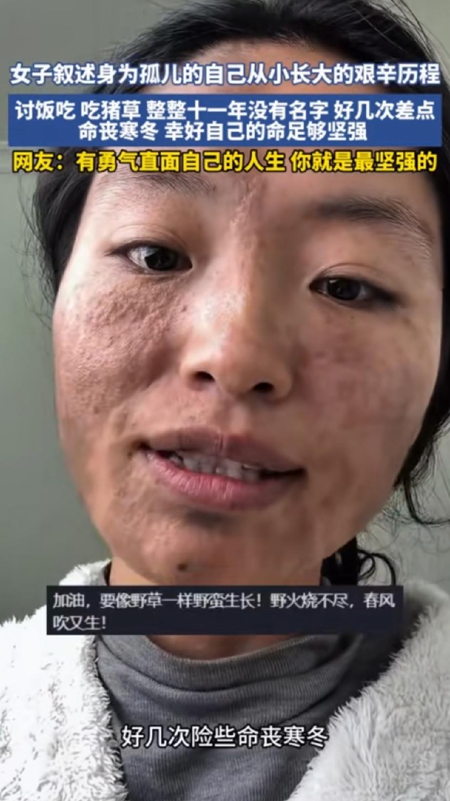 人到中年，泪点越来越低，看完心里久久不能平静
刷到这位姑娘的故事，瞬间破防。
从