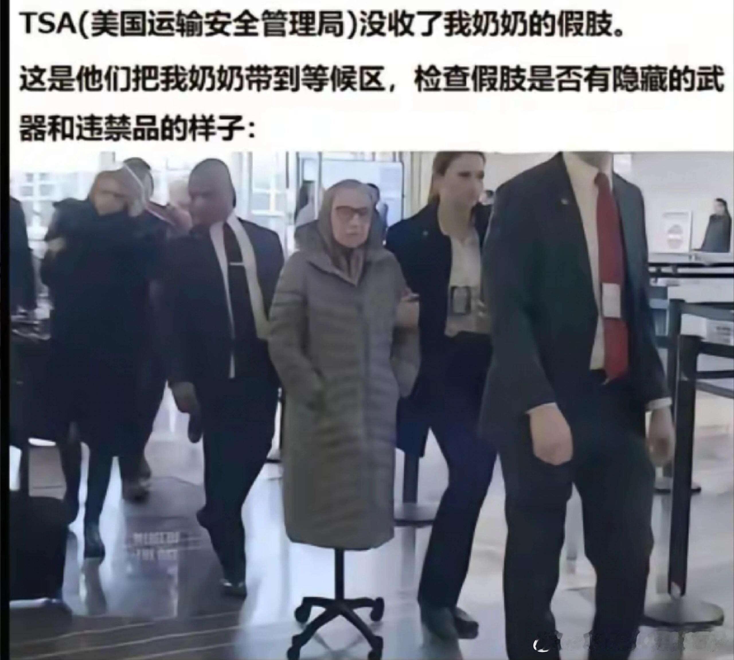 老奶：这玩意儿比假肢方便啊🤔🤔🤔 