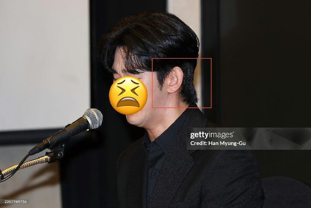 金秀贤假发金秀贤戴了假发  金秀贤戴了假发金秀贤和未成年金赛纶约会视频 ​​​