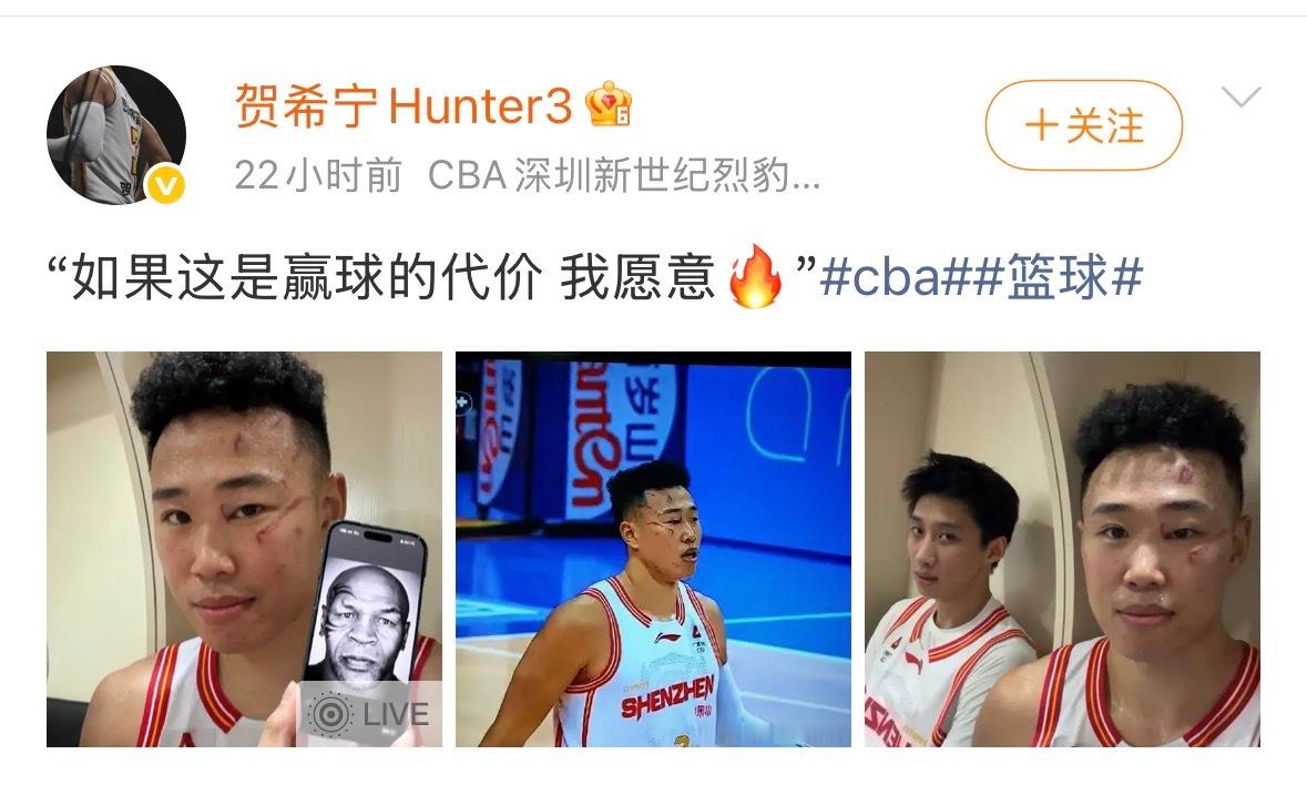 看到贺希宁这条微博，感慨CBA的强度令人发指，这是真正的肉搏战…另外球员打球之前