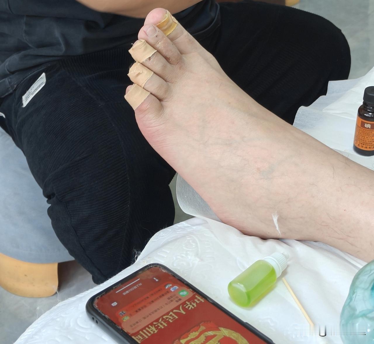 修脚这种看不起眼的行当还怪赚钱来！

昨天一个朋友修脚，我去找他，说是有灰指甲，