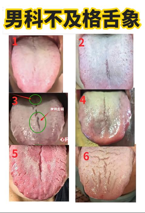 好几天没给大家看舌象了，今天继续——公益舌诊！