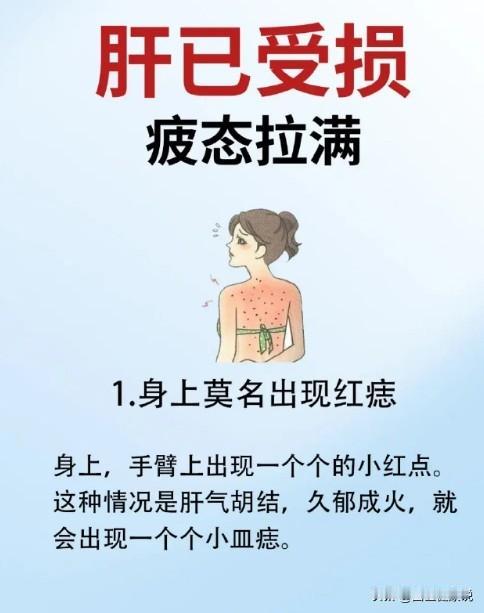 肝是一个不会表达的器官，及时发现肝的问题很重要，如果你有这些情况，要多关心你的肝