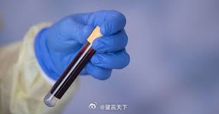 研究显示 Grail 多癌早筛测试误报率高，引发监管与医学界担忧 一、Grail