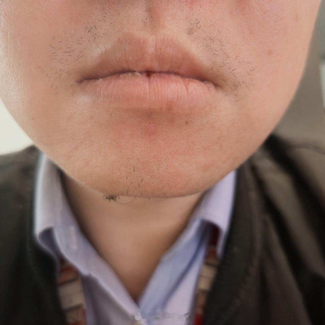 人上火是怎样的生物原理，怎么会让嘴唇干裂。仅仅半天时间就舌尖起泡，嘴唇干裂，再怎