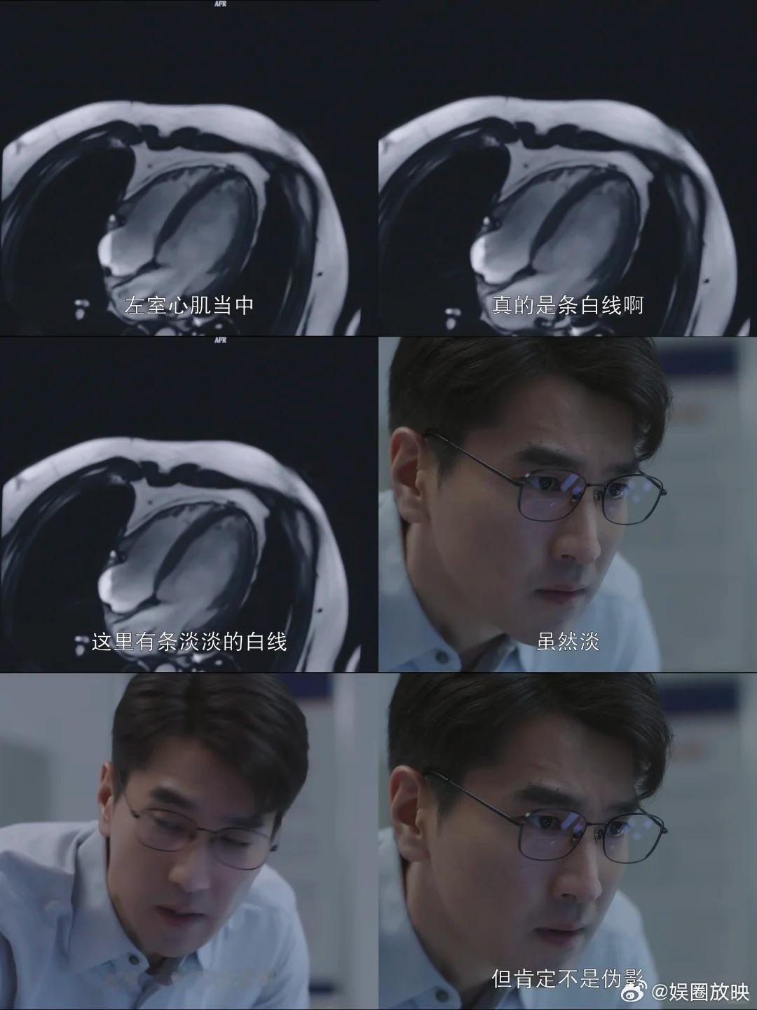 赵又廷演技层次感被赵又廷惊艳到！面对林逸质问面无波澜，眼神却藏满执念，周主任这段
