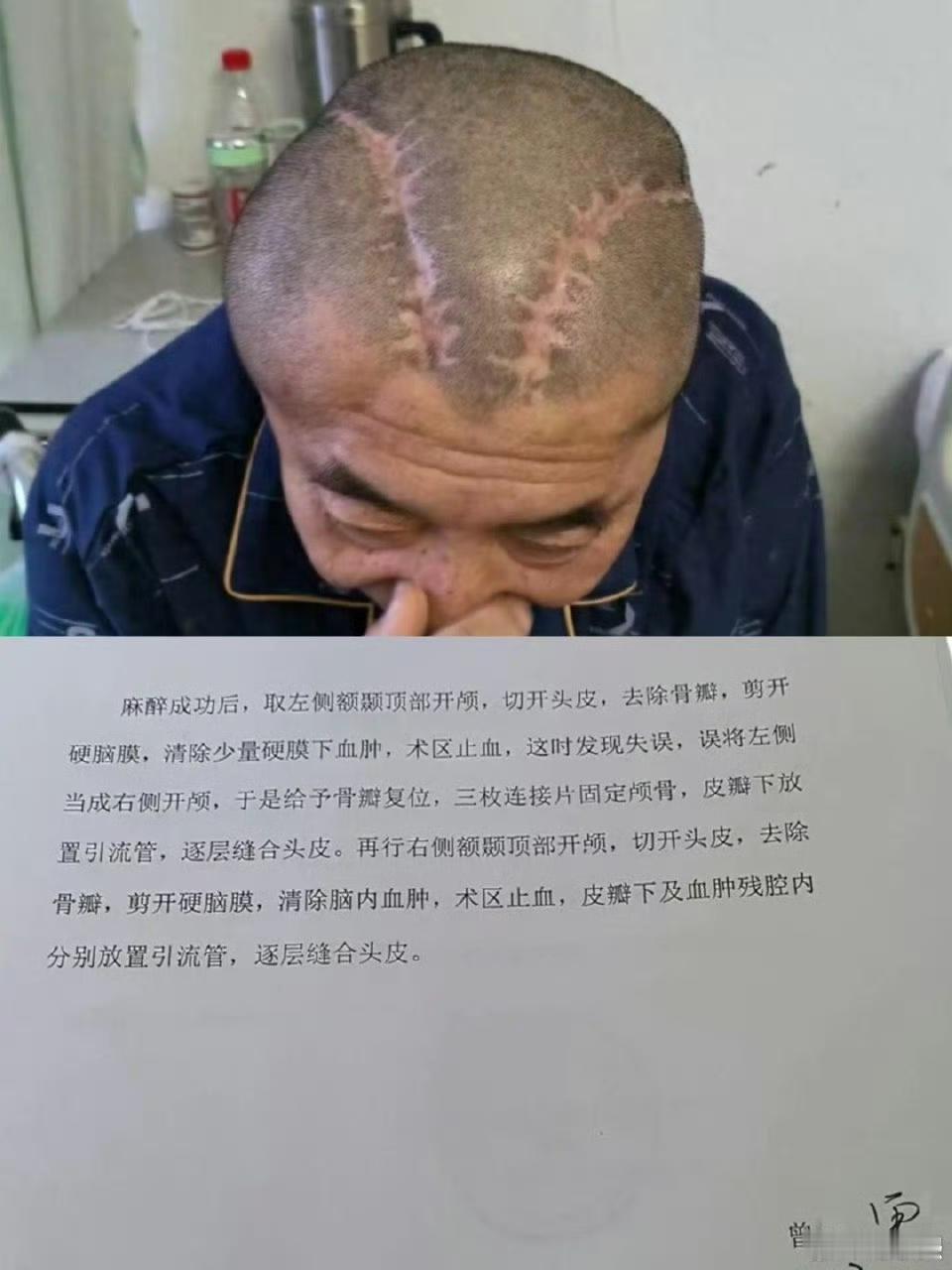 医疗事故警示！男子右脑出血被医生错开左脑，300万赔偿被拒还遭医院起诉
 
20