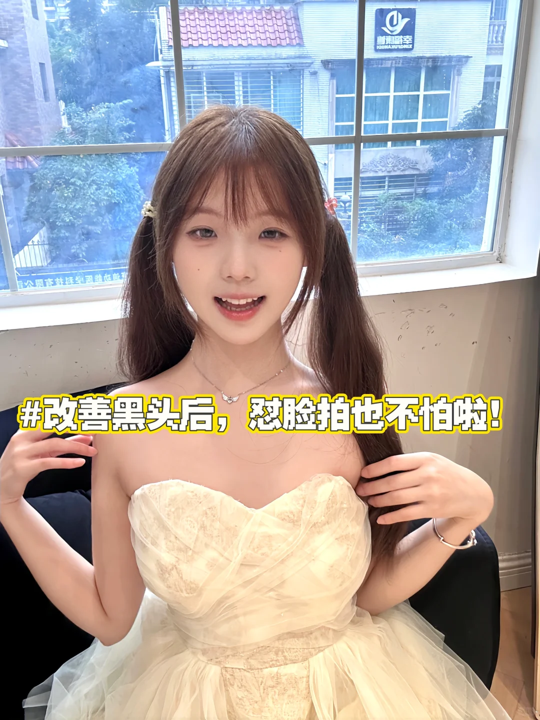 困扰我多年的黑头竟然这么容易就解决了