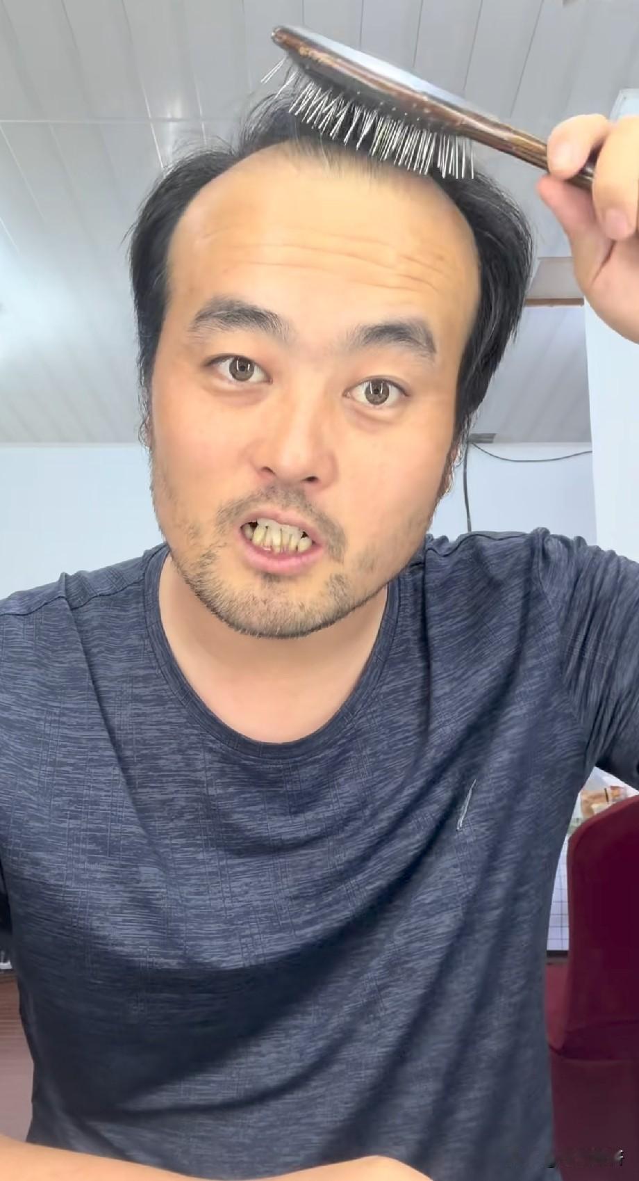 邵老五真实年龄曝光！比窦骁还小一岁，网友：岁月是把杀猪刀
 
谁能想到，镜头里满
